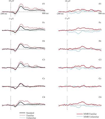 Dissociating Long and Short-term Memory in Three-Month-Old Infants Using the Mismatch Response to Voice Stimuli